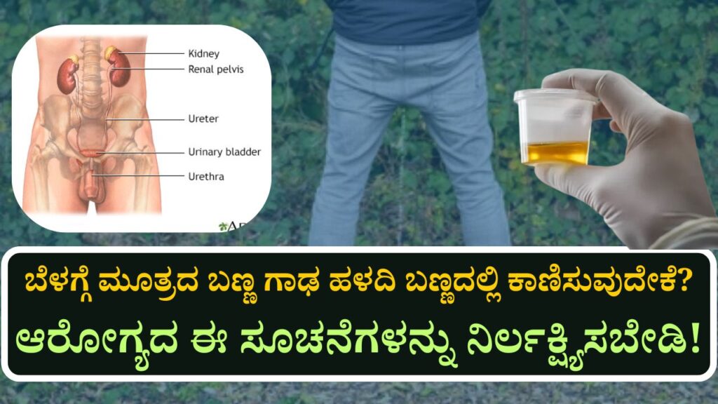 urine yellow color morning reason and health precautions