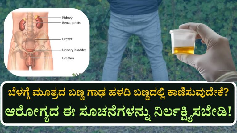 urine yellow color morning reason and health precautions