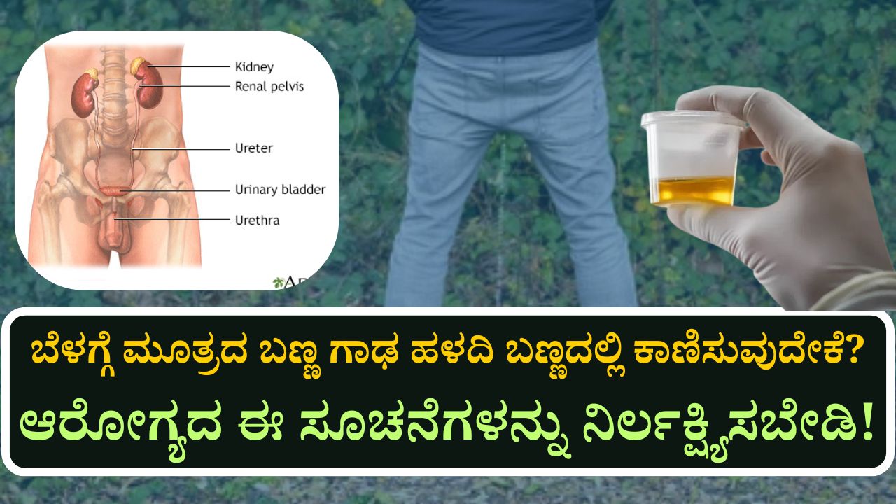 urine yellow color morning reason and health precautions